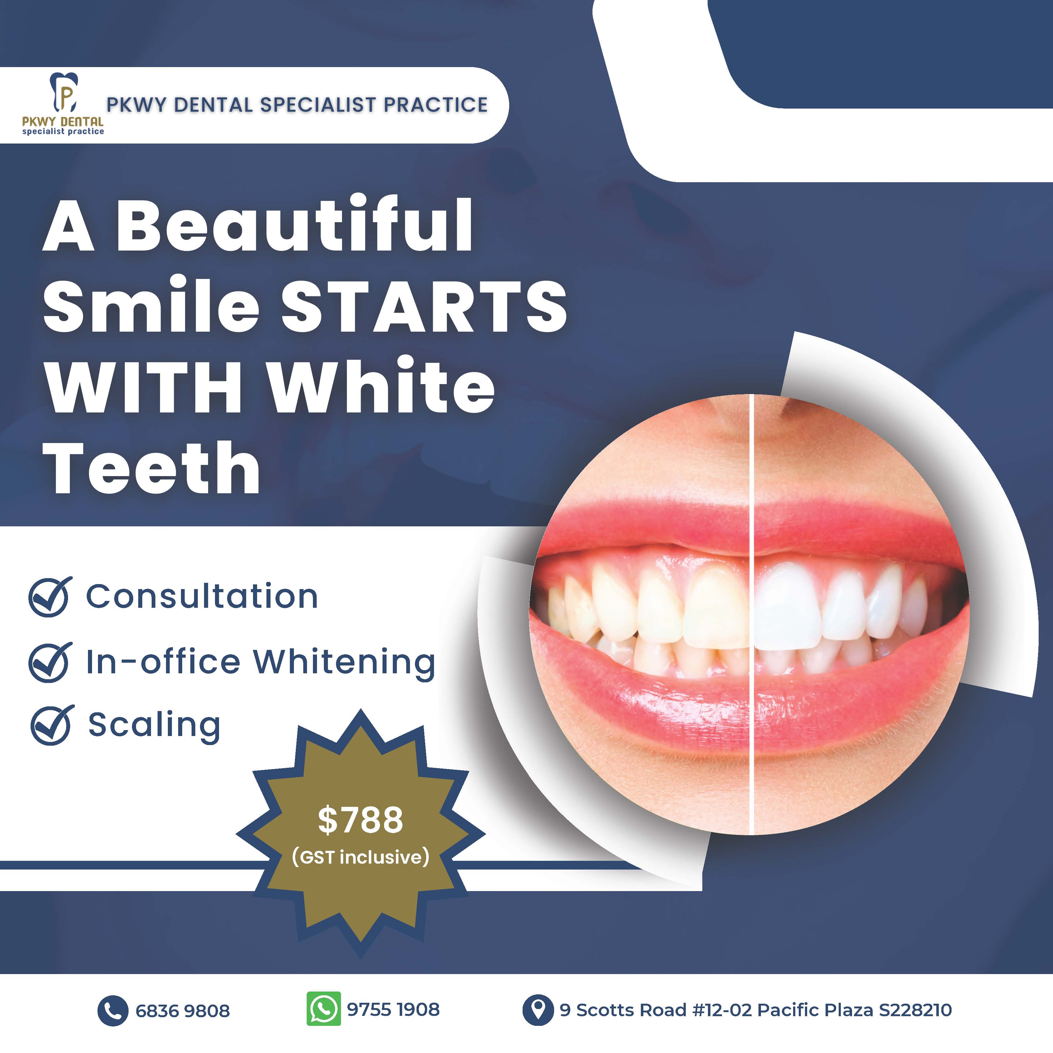 PKWY Dental - Promotion For In House Teeth Whitening | Ministry Of ...